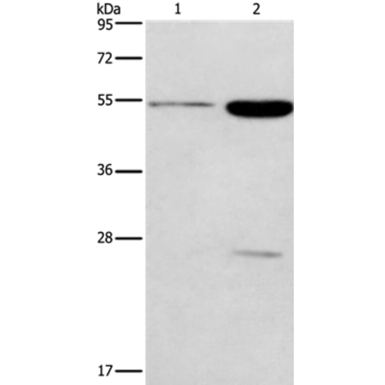 GABRG2 Antibody from Signalway Antibody (37584) - Antibodies.com