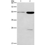 GABRG2 Antibody from Signalway Antibody (37584) - Antibodies.com