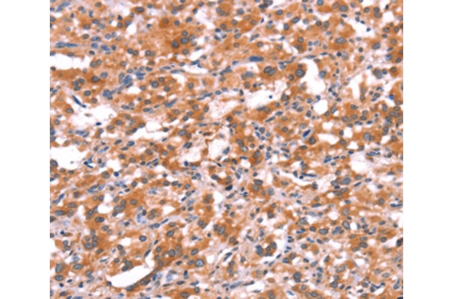 Immunohistochemistry - GABRG2 Antibody from Signalway Antibody (37584) - Antibodies.com