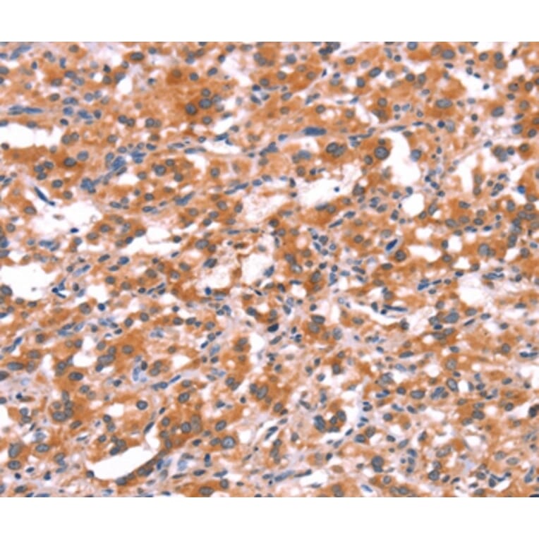 Immunohistochemistry - GABRG2 Antibody from Signalway Antibody (37584) - Antibodies.com