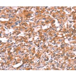 Immunohistochemistry - GABRG2 Antibody from Signalway Antibody (37584) - Antibodies.com