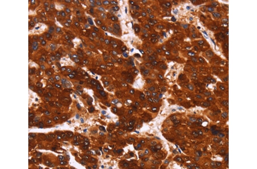 Immunohistochemistry - GPR124 Antibody from Signalway Antibody (37603) - Antibodies.com