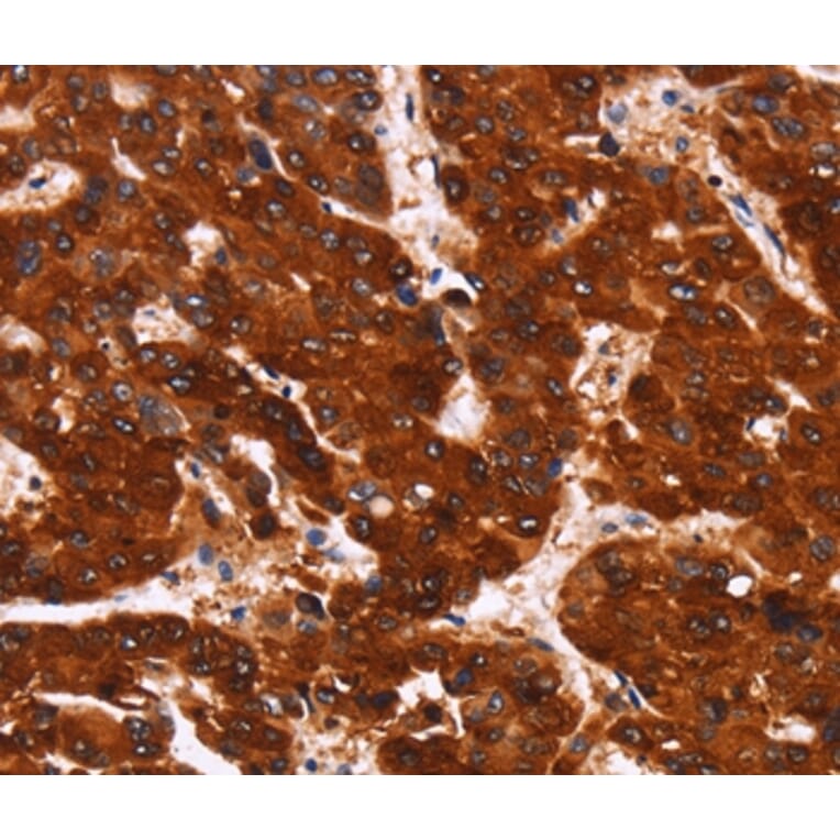Immunohistochemistry - GPR124 Antibody from Signalway Antibody (37603) - Antibodies.com