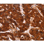 Immunohistochemistry - GPR124 Antibody from Signalway Antibody (37603) - Antibodies.com