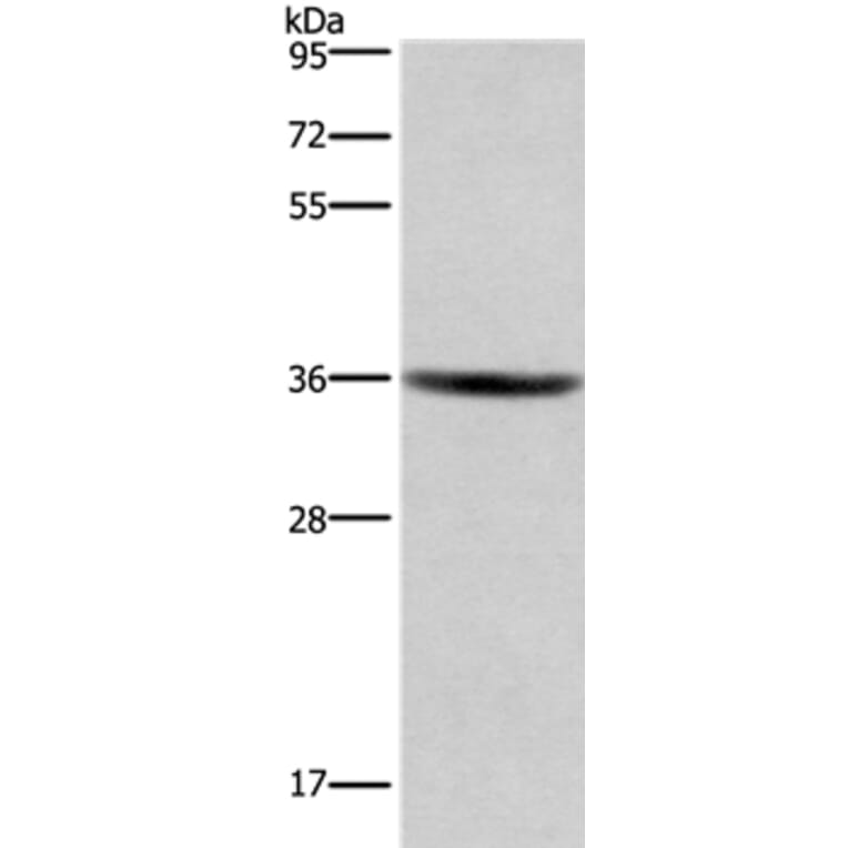 GPR171 Antibody from Signalway Antibody (37604) - Antibodies.com