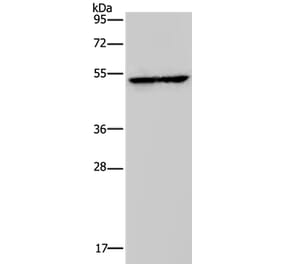 HMGCS2 Antibody from Signalway Antibody (37623) - Antibodies.com