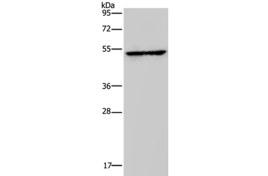 HMGCS2 Antibody from Signalway Antibody (37623) - Antibodies.com