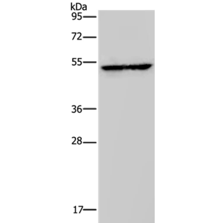 HMGCS2 Antibody from Signalway Antibody (37623) - Antibodies.com