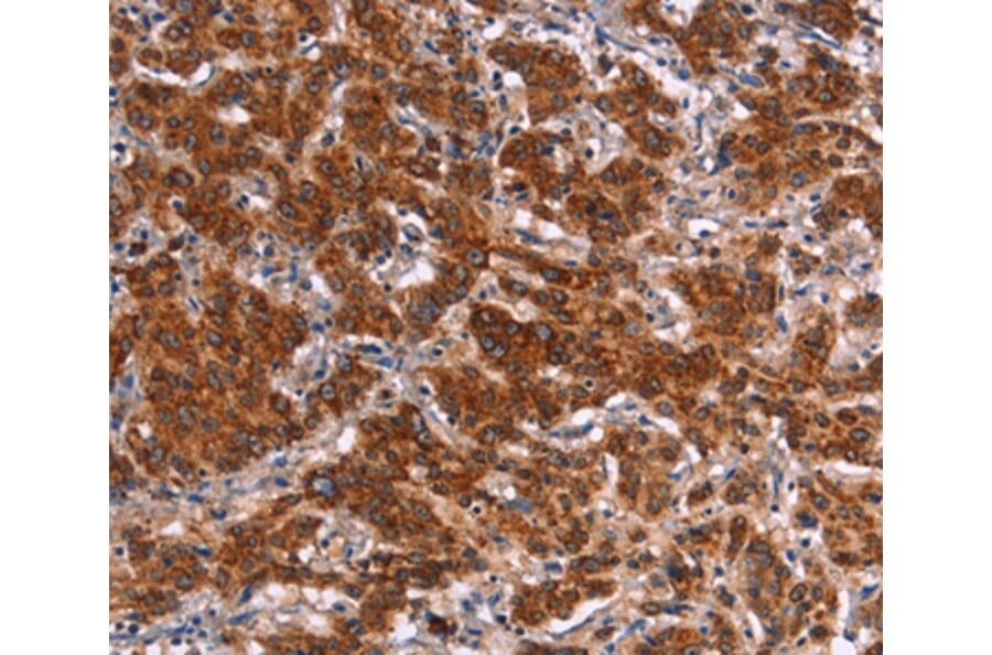 Immunohistochemistry - HMGCS2 Antibody from Signalway Antibody (37623) - Antibodies.com