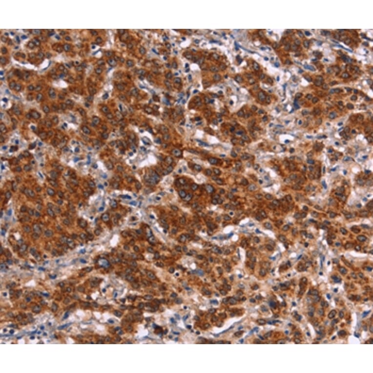Immunohistochemistry - HMGCS2 Antibody from Signalway Antibody (37623) - Antibodies.com