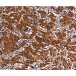 Immunohistochemistry - HMGCS2 Antibody from Signalway Antibody (37623) - Antibodies.com