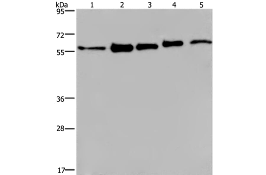 HNRNPL Antibody from Signalway Antibody (37624) - Antibodies.com