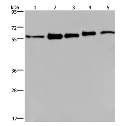 HNRNPL Antibody from Signalway Antibody (37624) - Antibodies.com
