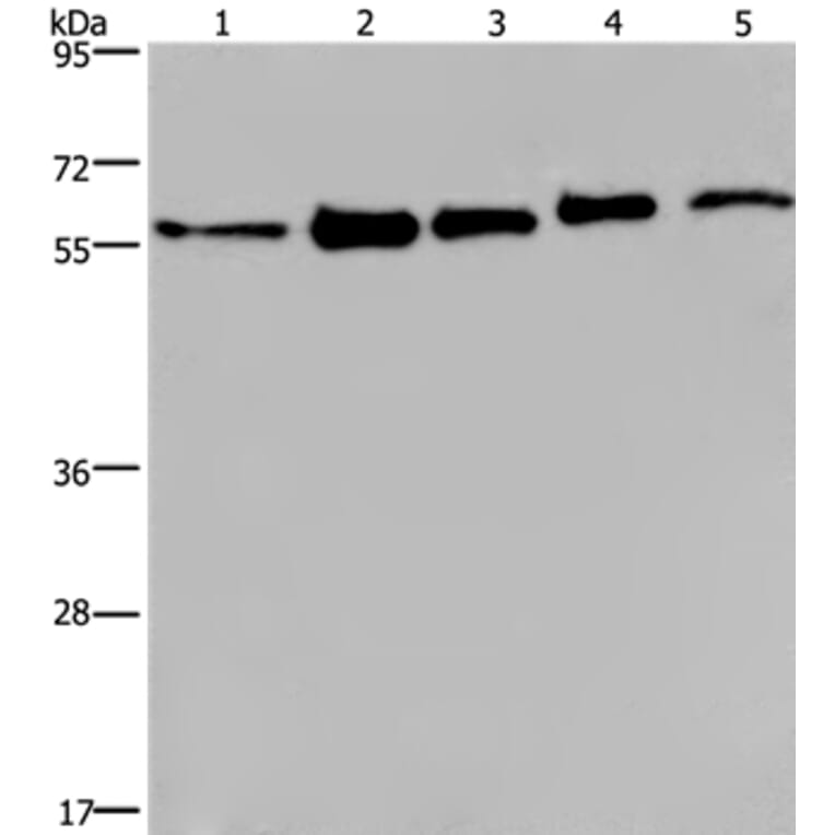 HNRNPL Antibody from Signalway Antibody (37624) - Antibodies.com