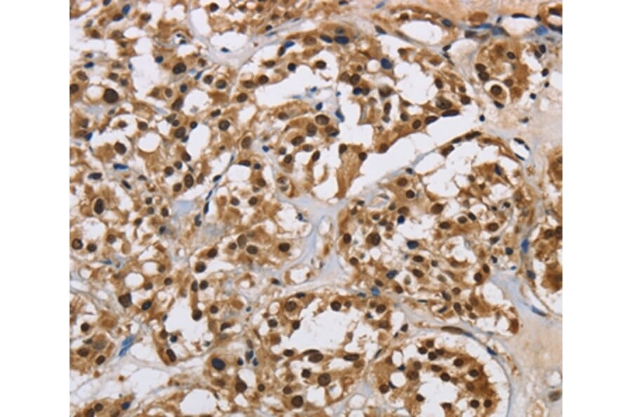 Immunohistochemistry - HNRNPL Antibody from Signalway Antibody (37624) - Antibodies.com