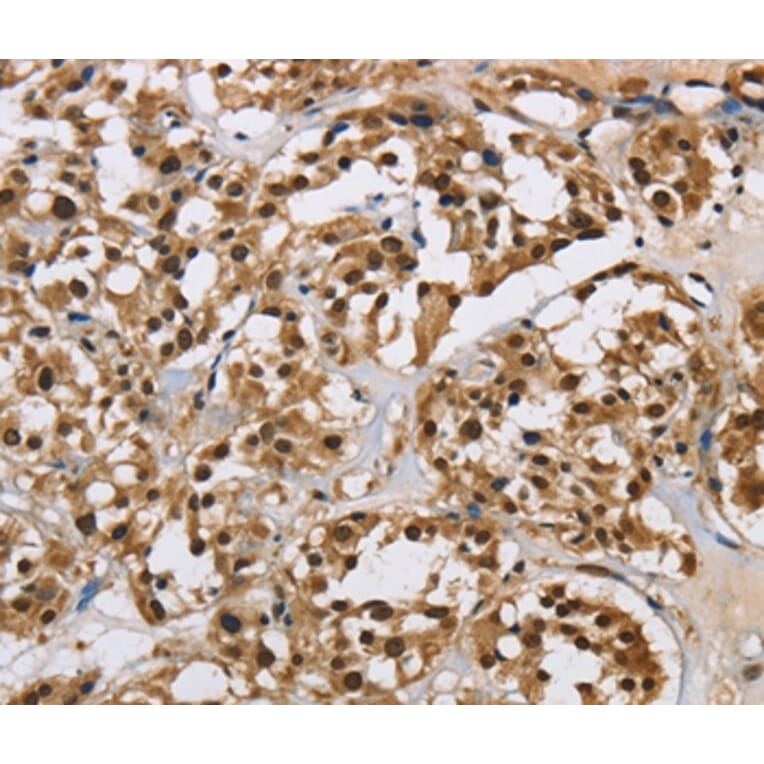 Immunohistochemistry - HNRNPL Antibody from Signalway Antibody (37624) - Antibodies.com