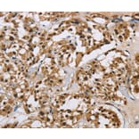 Immunohistochemistry - HNRNPL Antibody from Signalway Antibody (37624) - Antibodies.com