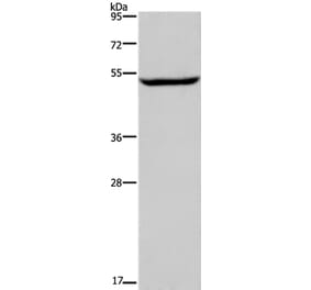 IMPDH1 Antibody from Signalway Antibody (37655) - Antibodies.com