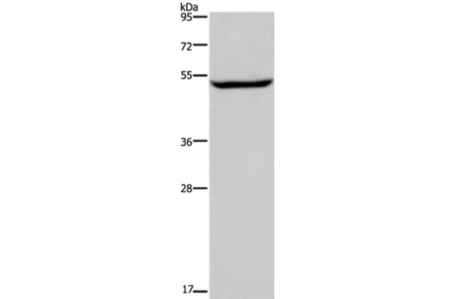 IMPDH1 Antibody from Signalway Antibody (37655) - Antibodies.com