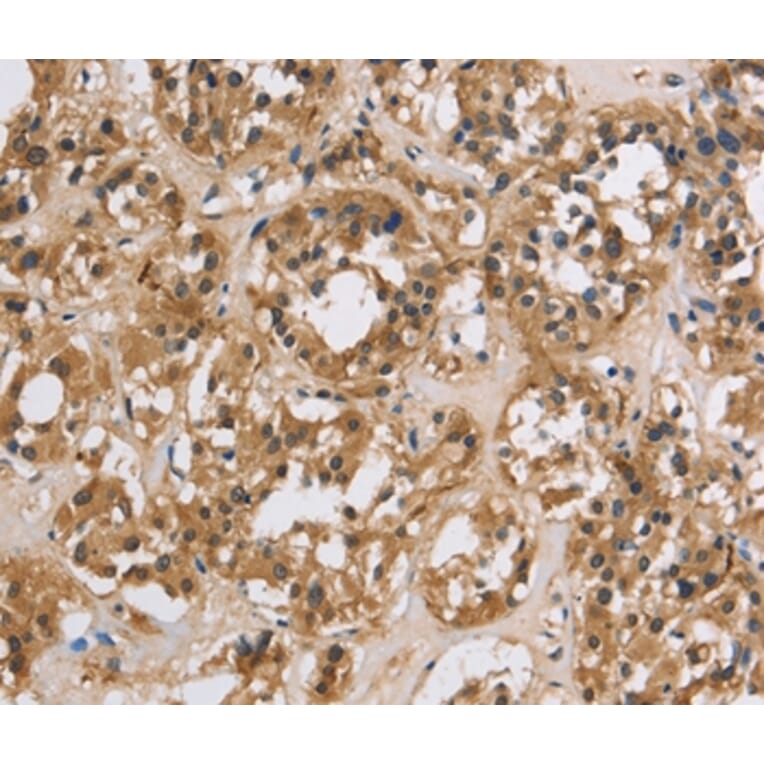 Immunohistochemistry - IMPDH1 Antibody from Signalway Antibody (37655) - Antibodies.com