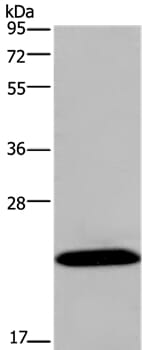 Gel: 10% SDS-PAGE Lysates (from left to right): Mouse brain tissue Amount of lysate: 40ug per lane Primary antibody: 1/500 dilution Secondary antibody dilution: 1/8000 Exposure time: 1 minute