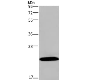 KCNMB4 Antibody from Signalway Antibody (37680) - Antibodies.com
