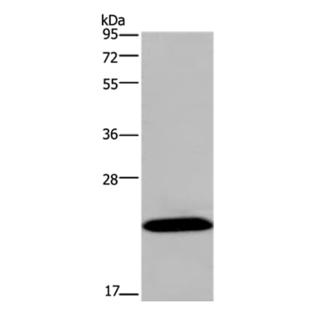 KCNMB4 Antibody from Signalway Antibody (37680) - Antibodies.com