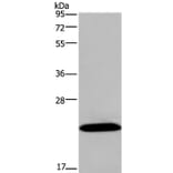 KCNMB4 Antibody from Signalway Antibody (37680) - Antibodies.com