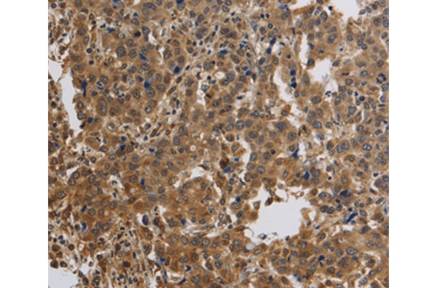 Immunohistochemistry - KCNMB4 Antibody from Signalway Antibody (37680) - Antibodies.com