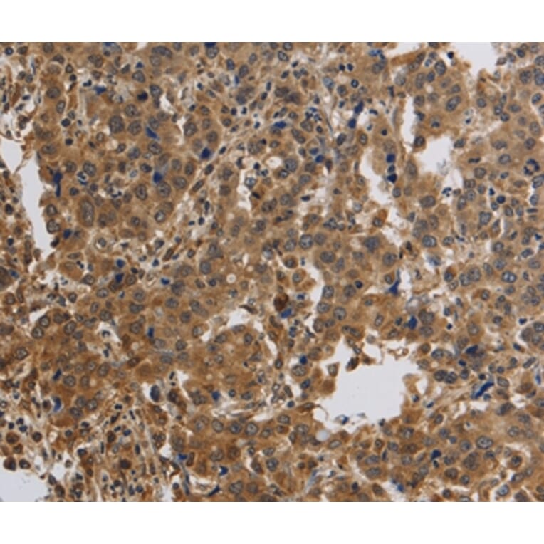 Immunohistochemistry - KCNMB4 Antibody from Signalway Antibody (37680) - Antibodies.com