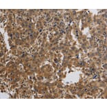 Immunohistochemistry - KCNMB4 Antibody from Signalway Antibody (37680) - Antibodies.com