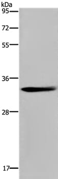 Gel: 10% SDS-PAGE Lysates (from left to right): Mouse thymus tissue Amount of lysate: 40ug per lane Primary antibody: 1/300 dilution Secondary antibody dilution: 1/8000 Exposure time: 20 seconds