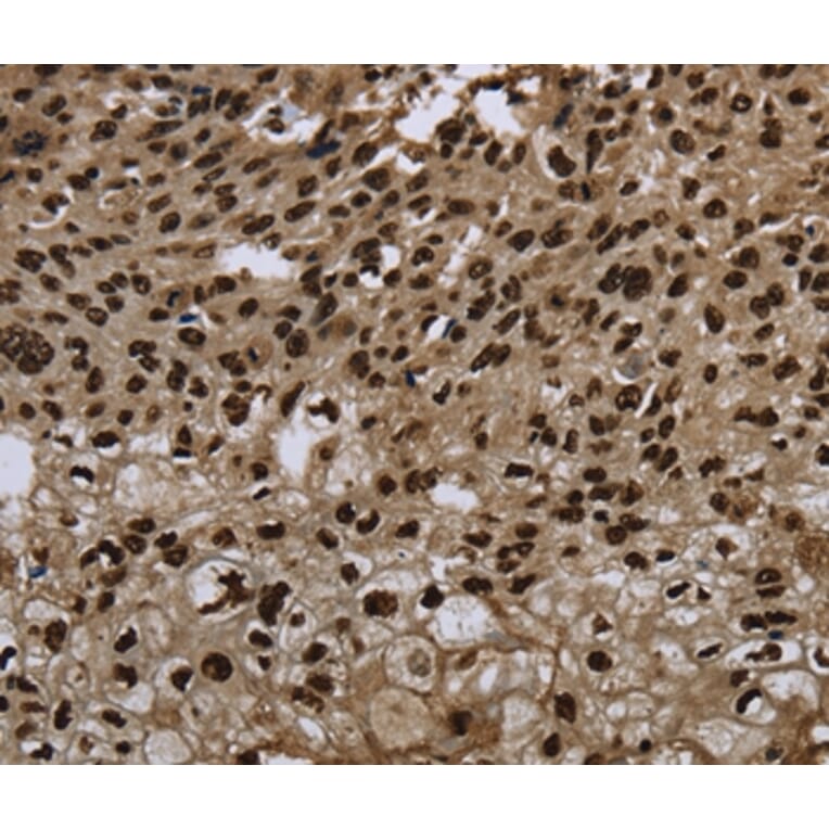 Immunohistochemistry - ANP32E Antibody from Signalway Antibody (37693) - Antibodies.com