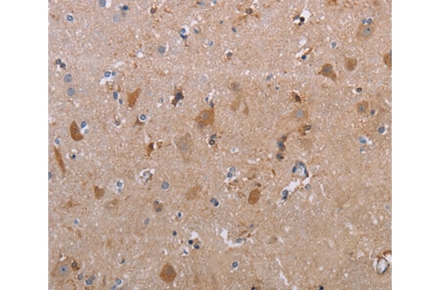 Immunohistochemistry - MAGEF1 Antibody from Signalway Antibody (37711) - Antibodies.com