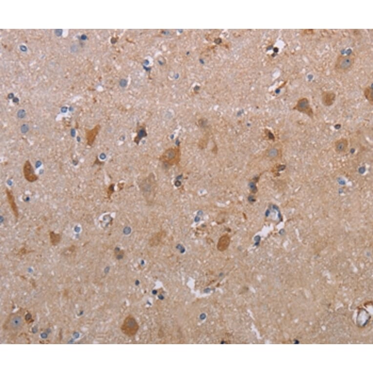 Immunohistochemistry - MAGEF1 Antibody from Signalway Antibody (37711) - Antibodies.com