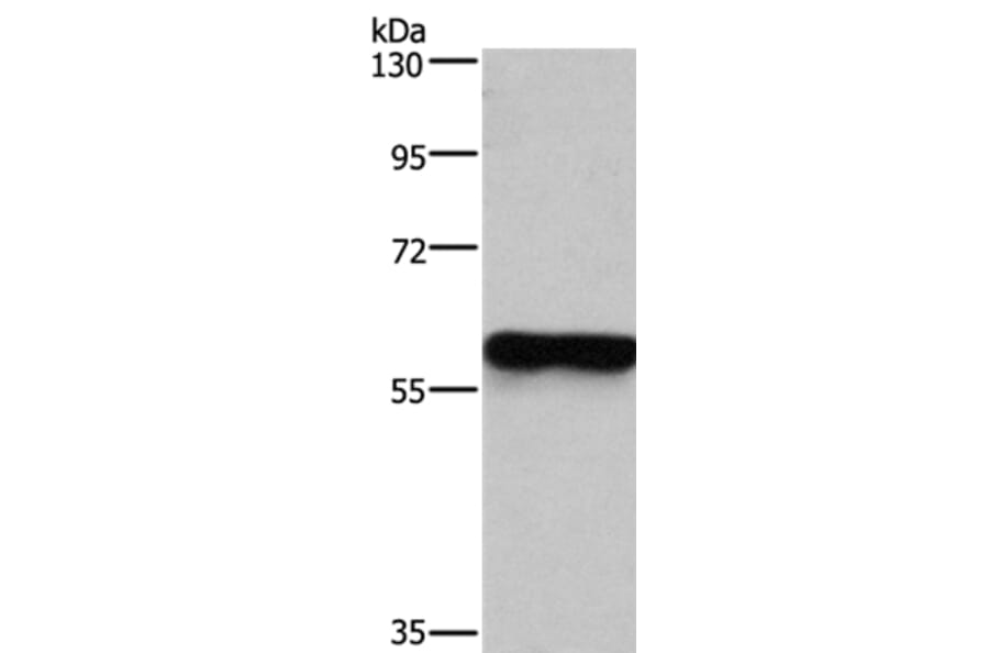 MFSD2A Antibody from Signalway Antibody (37724) - Antibodies.com