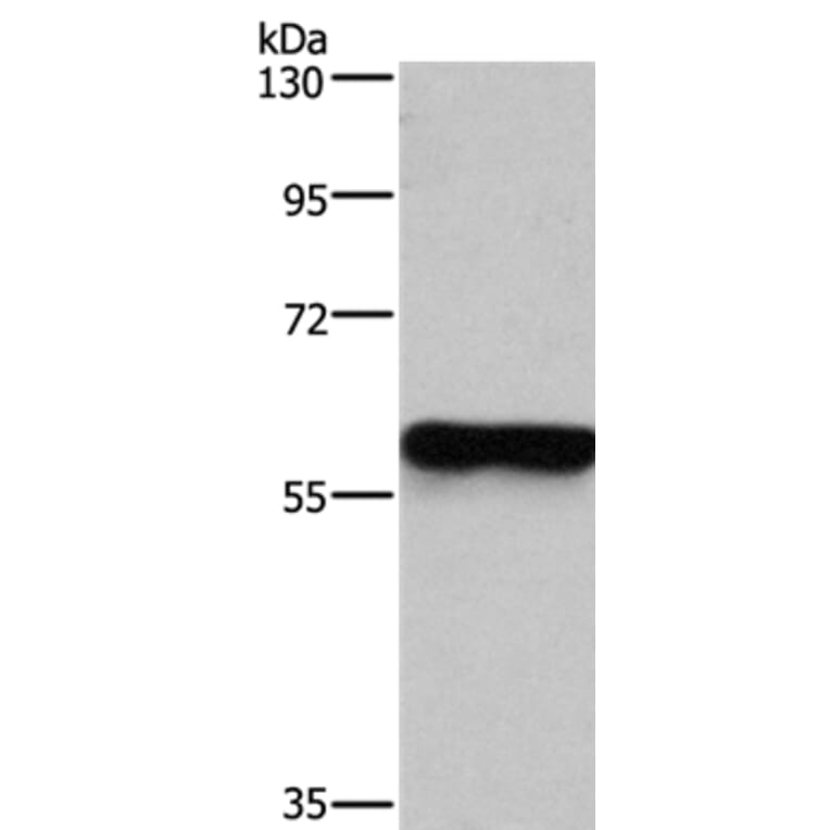 MFSD2A Antibody from Signalway Antibody (37724) - Antibodies.com
