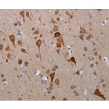 Immunohistochemistry - MFSD2A Antibody from Signalway Antibody (37724) - Antibodies.com