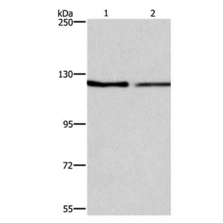ATP2A1 Antibody from Signalway Antibody (37728) - Antibodies.com