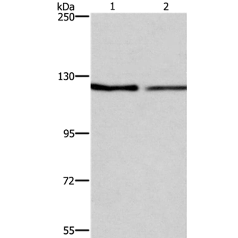 ATP2A1 Antibody from Signalway Antibody (37728) - Antibodies.com