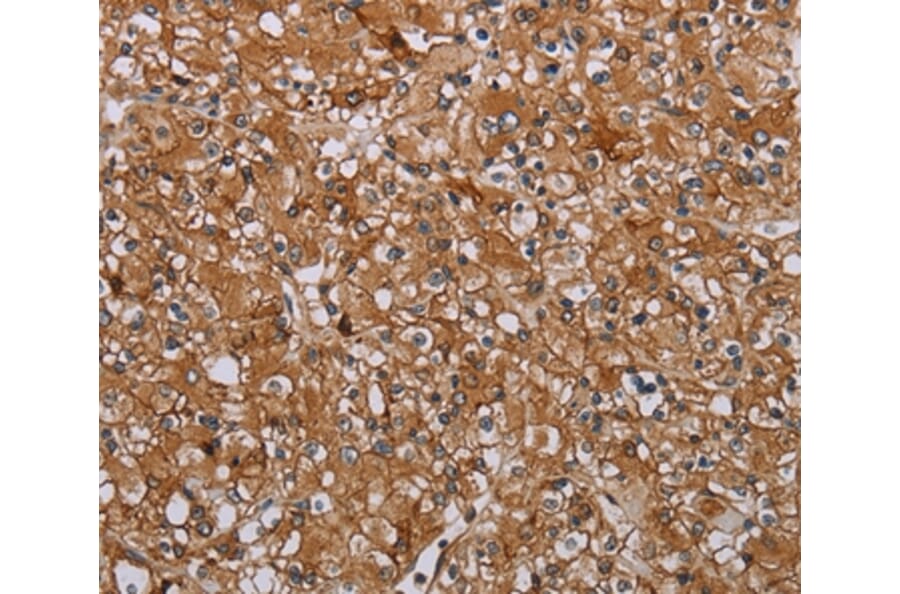 Immunohistochemistry - ATP2A1 Antibody from Signalway Antibody (37728) - Antibodies.com