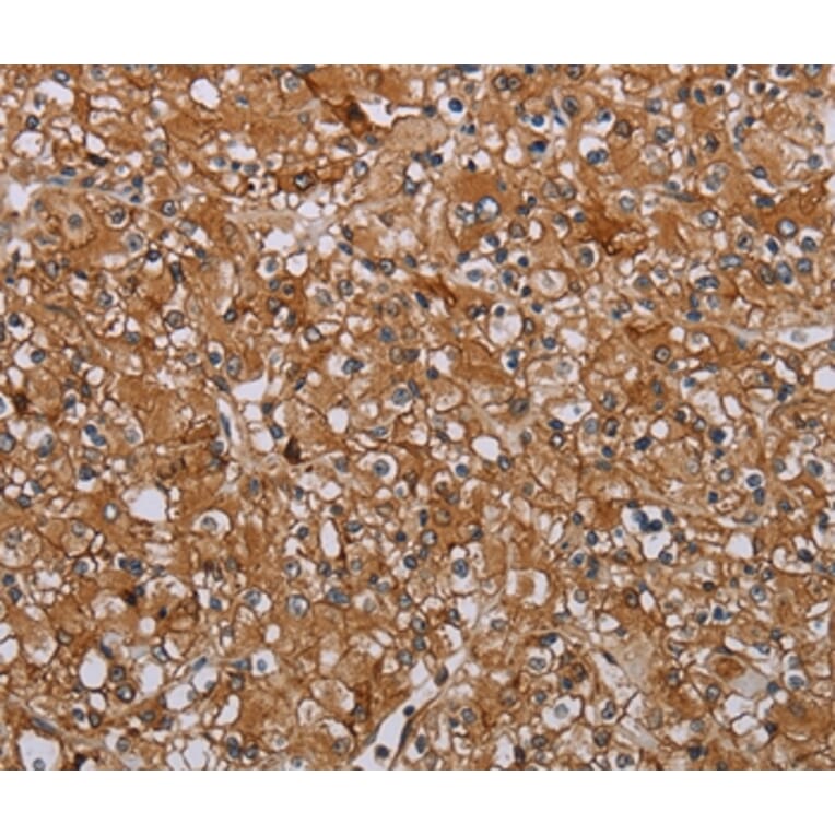 Immunohistochemistry - ATP2A1 Antibody from Signalway Antibody (37728) - Antibodies.com