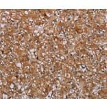Immunohistochemistry - ATP2A1 Antibody from Signalway Antibody (37728) - Antibodies.com
