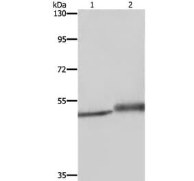 ERRFI1 Antibody from Signalway Antibody (37731) - Antibodies.com