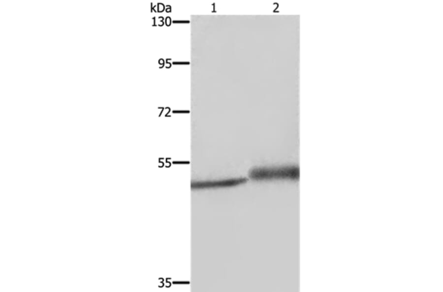 ERRFI1 Antibody from Signalway Antibody (37731) - Antibodies.com