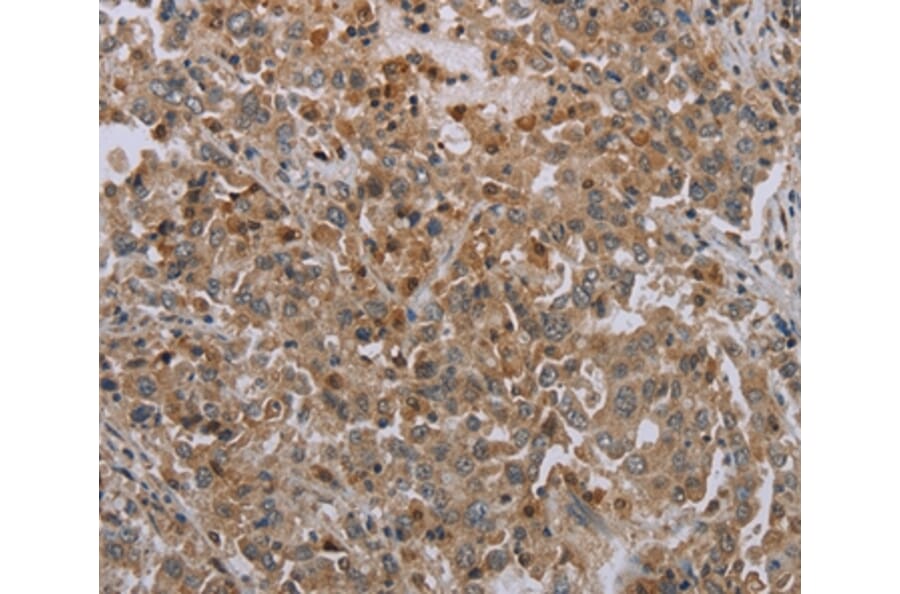 Immunohistochemistry - ERRFI1 Antibody from Signalway Antibody (37731) - Antibodies.com