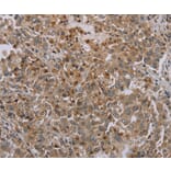 Immunohistochemistry - ERRFI1 Antibody from Signalway Antibody (37731) - Antibodies.com