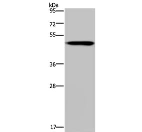 NDUFS2 Antibody from Signalway Antibody (37757) - Antibodies.com