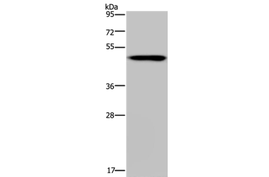 NDUFS2 Antibody from Signalway Antibody (37757) - Antibodies.com
