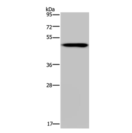 NDUFS2 Antibody from Signalway Antibody (37757) - Antibodies.com